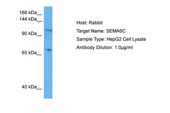 SEMA6C Rabbit Polyclonal Antibody