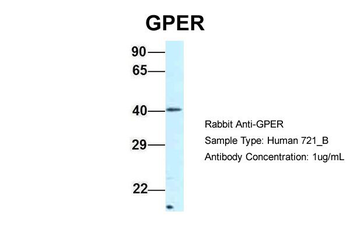 GPER Rabbit Polyclonal Antibody