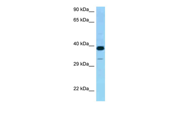 CRELD2 Rabbit Polyclonal Antibody