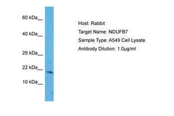 NDUFB7 Rabbit Polyclonal Antibody