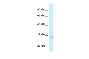 GADD45GIP1 Rabbit Polyclonal Antibody