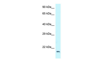 DCTN3 Rabbit Polyclonal Antibody