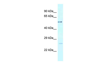 ENTPD3 Rabbit Polyclonal Antibody