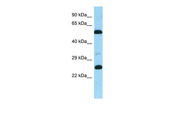 GPR37L1 Rabbit Polyclonal Antibody