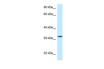 GMPR Rabbit Polyclonal Antibody