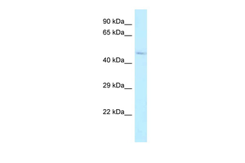 ALDH3B2 Rabbit Polyclonal Antibody