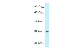 CCDC102B Rabbit Polyclonal Antibody