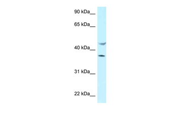 HLA-E Rabbit Polyclonal Antibody