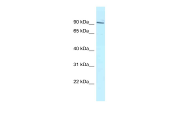 MTUS2 Rabbit Polyclonal Antibody