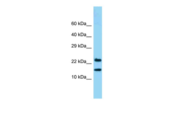 NDUFB10 Rabbit Polyclonal Antibody