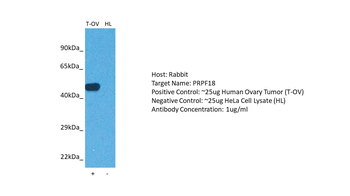 PRPF18 Rabbit Polyclonal Antibody