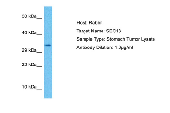 SEC13 Rabbit Polyclonal Antibody