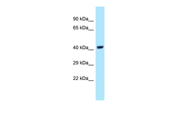 UBE2Q1 Rabbit Polyclonal Antibody