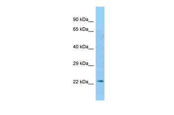 HLA-A Rabbit Polyclonal Antibody