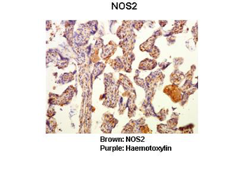 NOS2 Rabbit Polyclonal Antibody