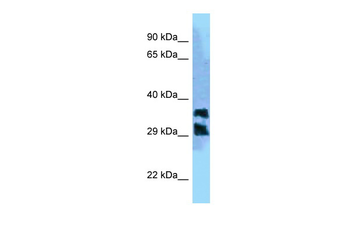 PGP Rabbit Polyclonal Antibody