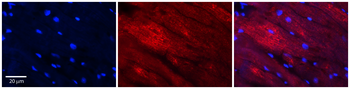 MCC Rabbit Polyclonal Antibody