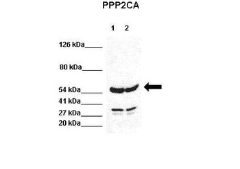PPP2CA Rabbit Polyclonal Antibody