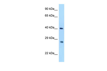 AIDA Rabbit Polyclonal Antibody