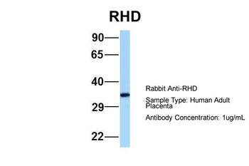 RHD Rabbit Polyclonal Antibody