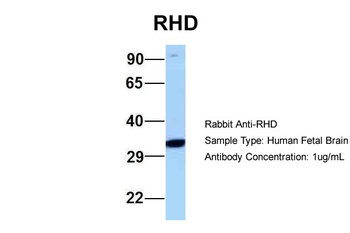 RHD Rabbit Polyclonal Antibody