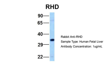 RHD Rabbit Polyclonal Antibody