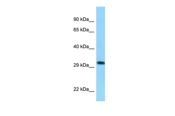 RHD Rabbit Polyclonal Antibody
