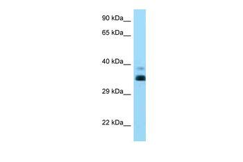 HLA-G Rabbit Polyclonal Antibody