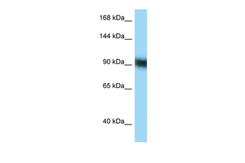 ZFP62 Rabbit Polyclonal Antibody