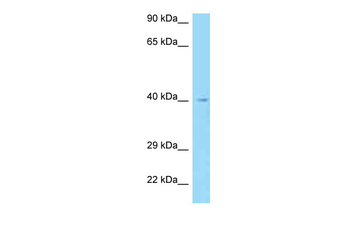 AADACL3 Rabbit Polyclonal Antibody