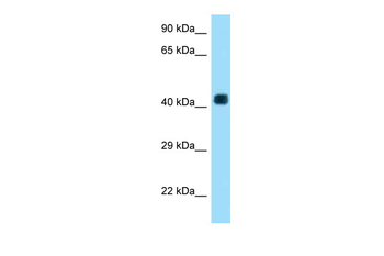 AADACL3 Rabbit Polyclonal Antibody