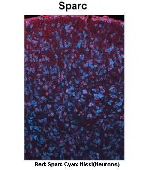 SPARC Rabbit Polyclonal Antibody