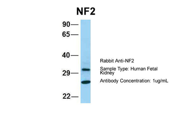 NF2 Rabbit Polyclonal Antibody