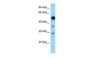 NF2 Rabbit Polyclonal Antibody