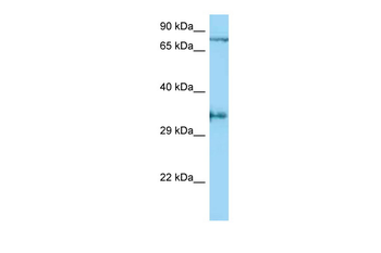 AQP4 Rabbit Polyclonal Antibody