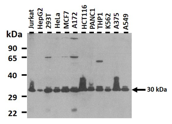 CD81 Rabbit Polyclonal Antibody