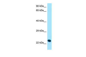 KLRK1 Rabbit Polyclonal Antibody