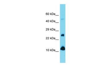 Vamp1 Rabbit Polyclonal Antibody