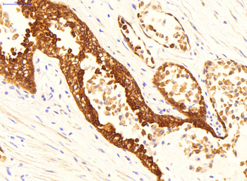 DPP4 Rabbit Polyclonal Antibody