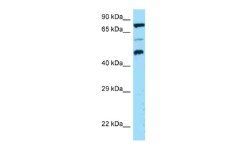 DPP4 Rabbit Polyclonal Antibody