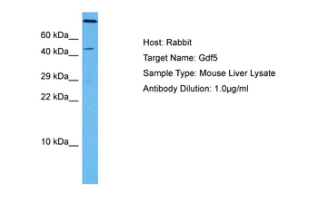 GDF5 Rabbit Polyclonal Antibody