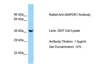 ADIPOR1 Rabbit Polyclonal Antibody