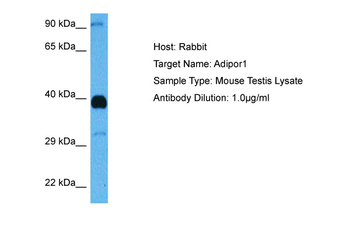 ADIPOR1 Rabbit Polyclonal Antibody
