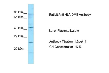 HLA-DMB Rabbit Polyclonal Antibody