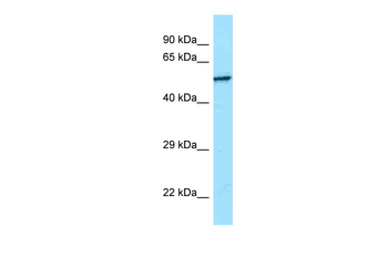SRMS Rabbit Polyclonal Antibody
