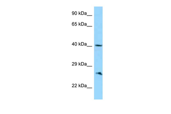 ABI1 Rabbit Polyclonal Antibody
