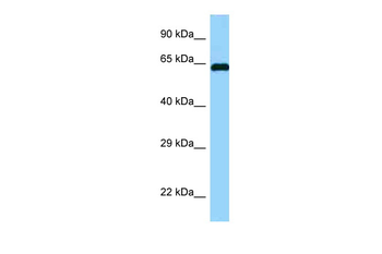 ABI1 Rabbit Polyclonal Antibody