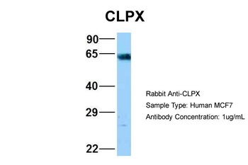 CLPX Rabbit Polyclonal Antibody