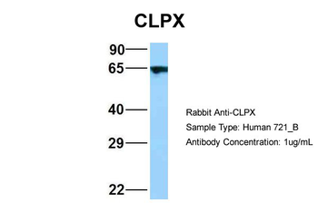 CLPX Rabbit Polyclonal Antibody