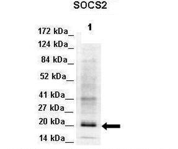 SOCS2 Rabbit Polyclonal Antibody